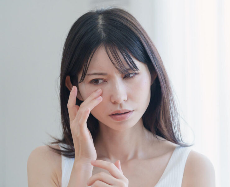 Red Flaky Nose? It May Be Seborrheic Dermatitis