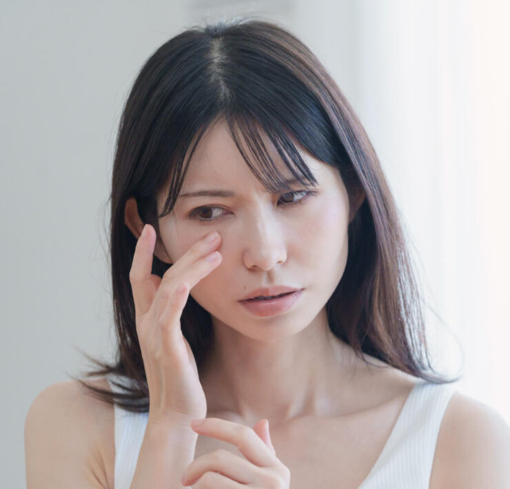 Red Flaky Nose? It May Be Seborrheic Dermatitis