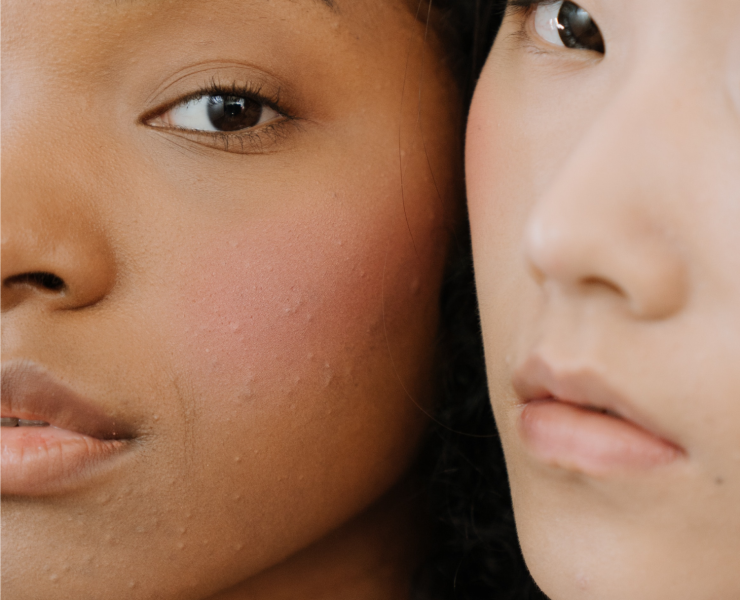 Our Top 10 Best Salicylic Acid Cosmetics