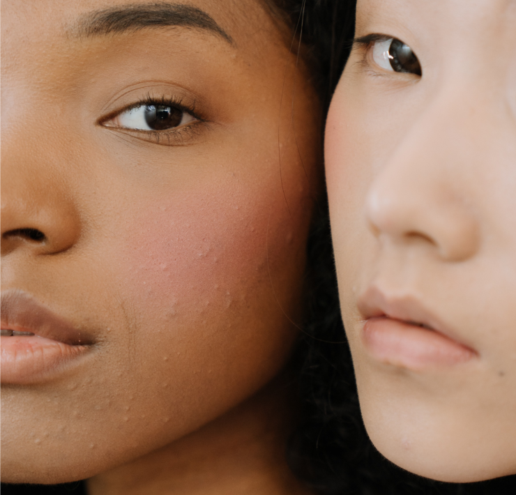 Our Top 10 Best Salicylic Acid Cosmetics