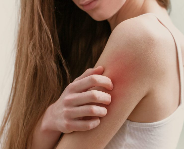 Best Creams for Itchy Skin Relief