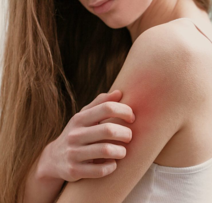 Best Creams for Itchy Skin Relief
