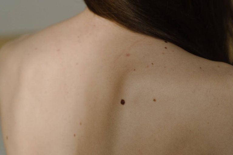 Best Body Wash For Acne On Back & Chest · Care to Beauty