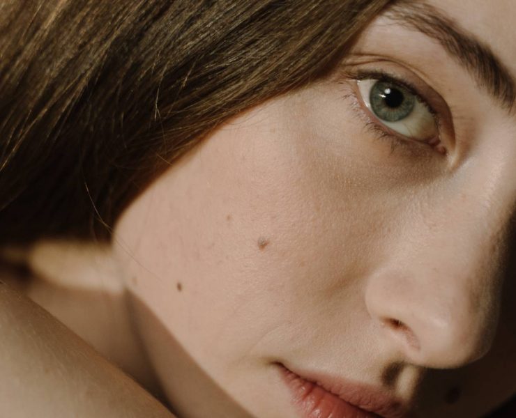 rosacea-skincare-routine