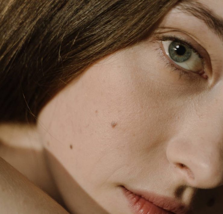 rosacea-skincare-routine