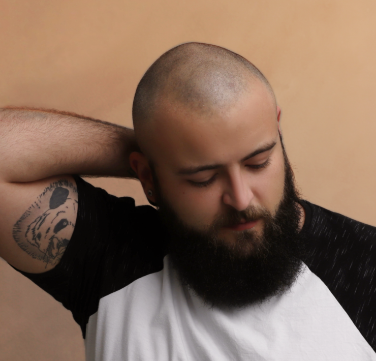 shaved bald head care