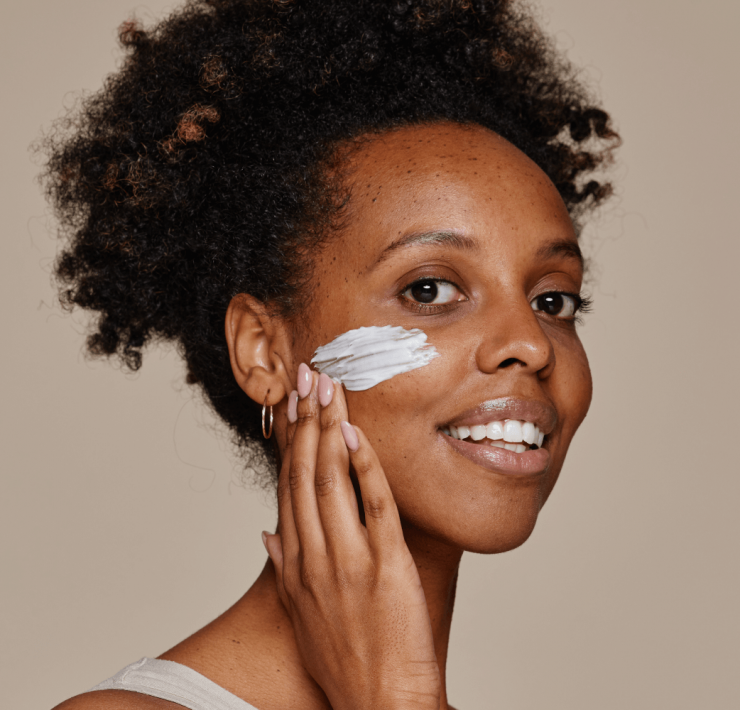 How to Manage Post-inflammatory Hyperpigmentation