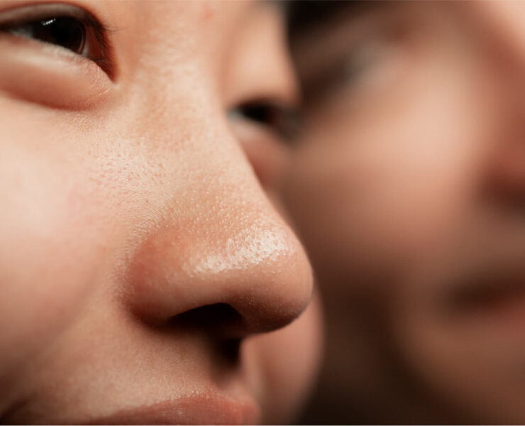 This is Why You Have "Large" Pores