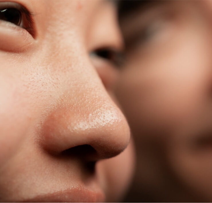 This is Why You Have "Large" Pores