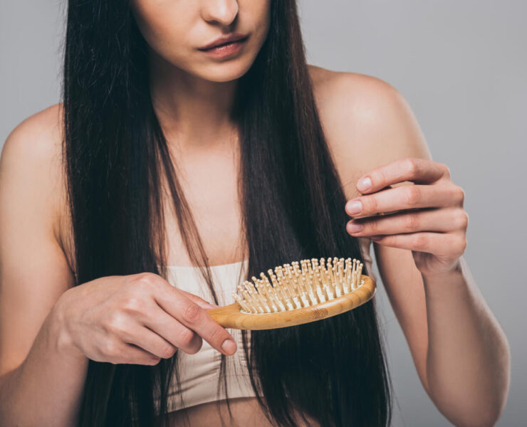 Types of Hair Loss: What You Need to Know