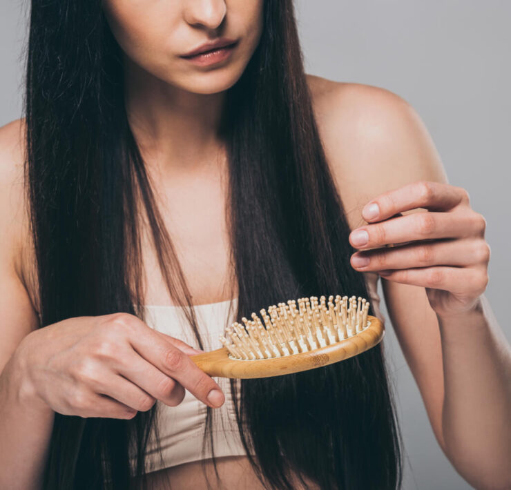 Types of Hair Loss: What You Need to Know